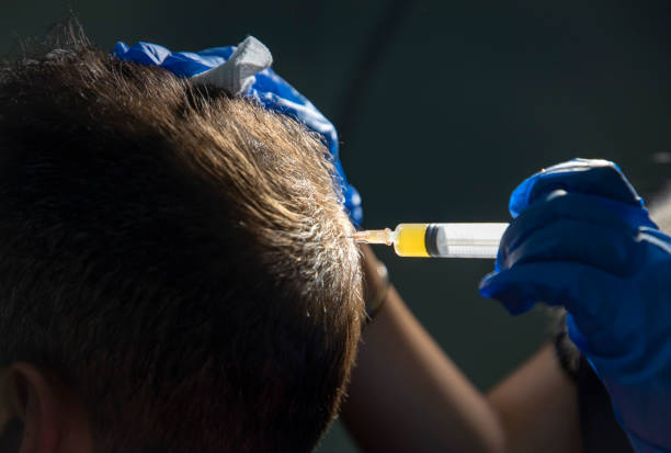 How Hair Care Habits Can Make or Break Your Results PRP Hair Treatment in Islamabad: