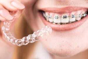 orthodontic treatment in oshiwara