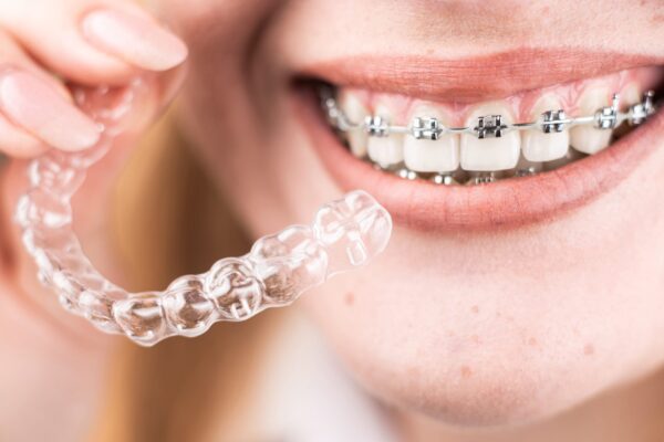 orthodontic treatment in oshiwara