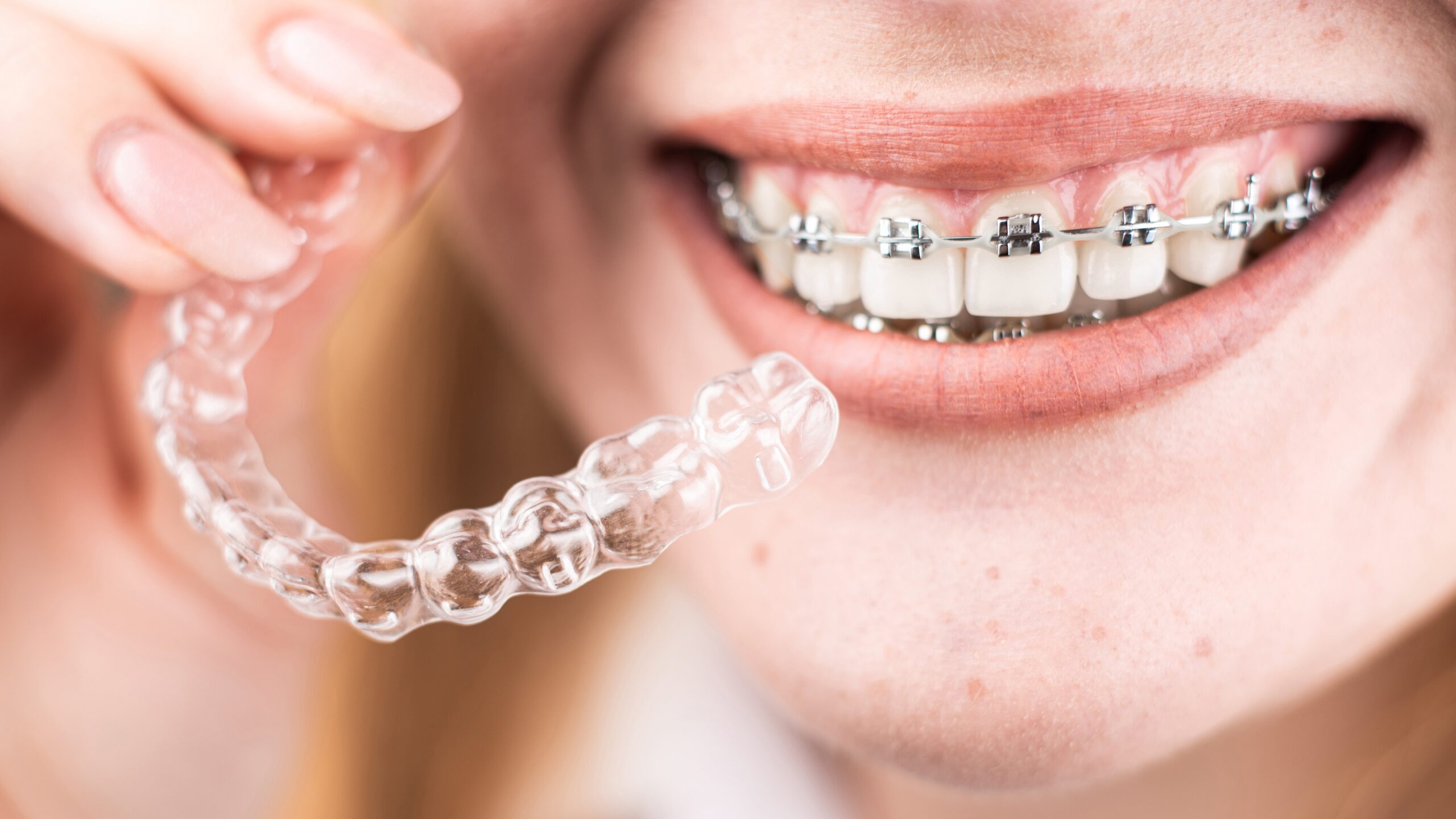 orthodontic treatment in oshiwara