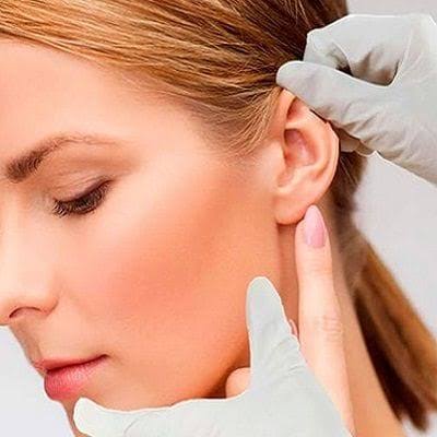 Otoplasty In Islamabad