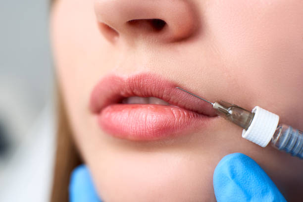 Are Lip Fillers Injection Suitable for Every Lip Type