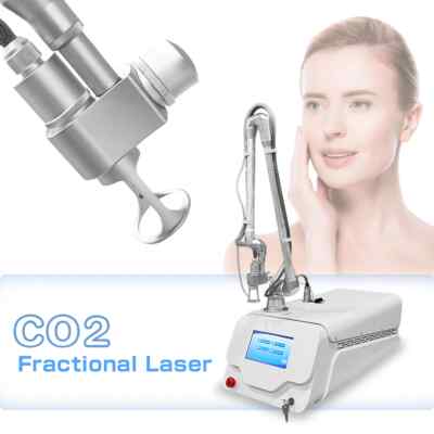 Patient receiving CO2 hand rejuvenation laser treatment to reduce wrinkles and age spots on aging hands in Bourbonnais IL.