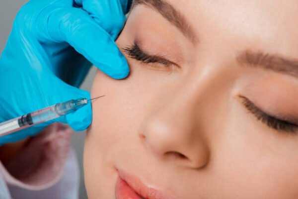 Can Cheek Fillers Injections improve skin support