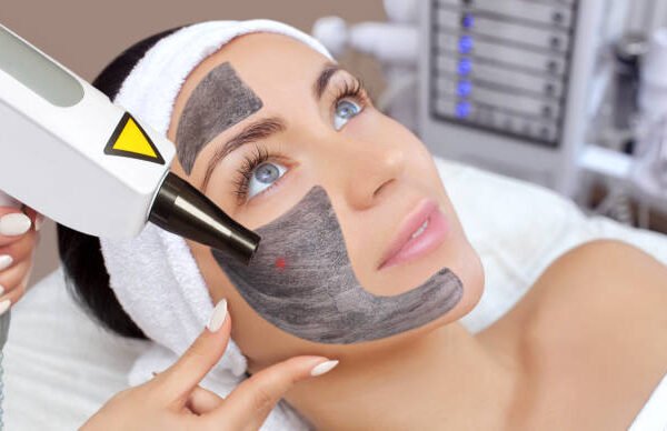 Can Laser Carbon Peeling Brighten Dull Skin