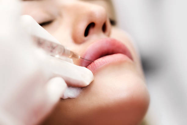 Can Lip Fillers Injection Correct Thin Lips