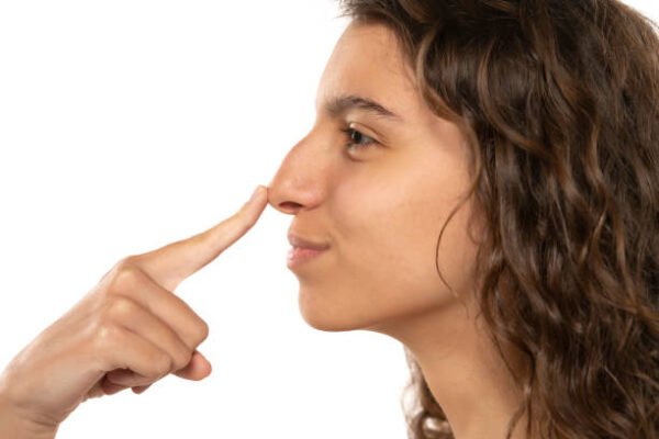 Can Liquid Rhinoplasty Lift the Nasal Tip