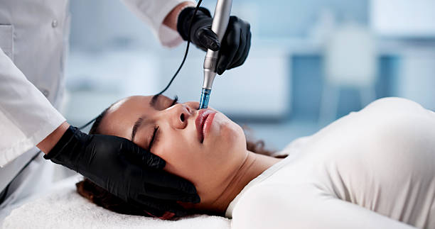 Can Microneedling for Acne Scars deliver smooth skin