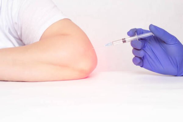 Can Stem Cell Therapy Improve Bone and Tissue Health