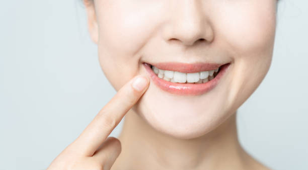 Can Teeth Whitening Brighten Yellow Teeth