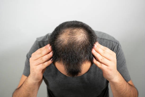 Can a Trichologist improve hair regrowth