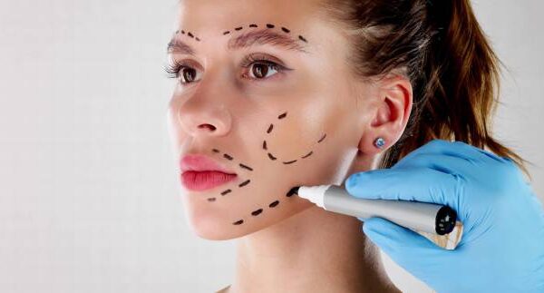 Can the best plastic surgeon restore facial balance