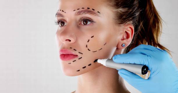 Can the best plastic surgeon restore facial balance