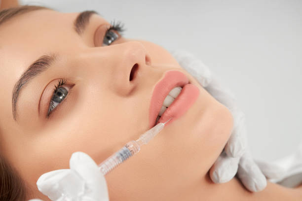 Do Russian Lip Fillers help restore lost lip volume