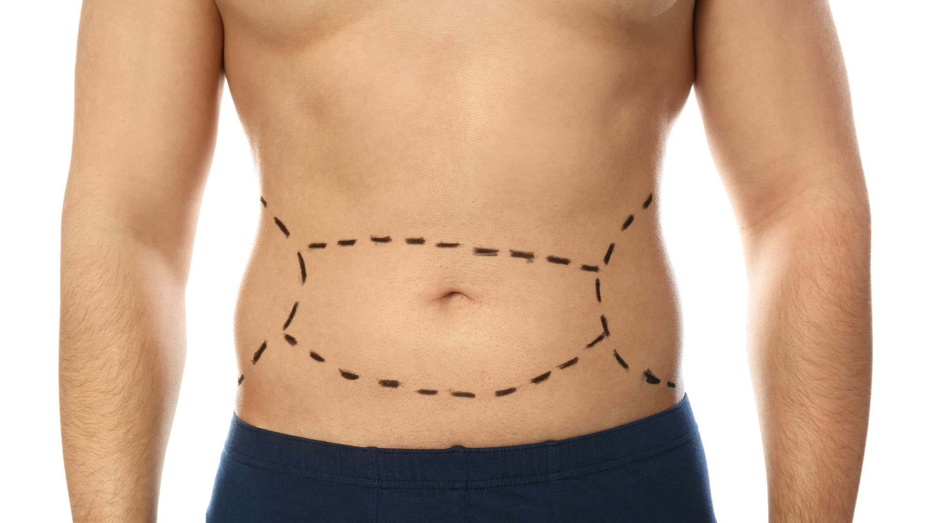 Bariatric Surgery Abu Dhabi