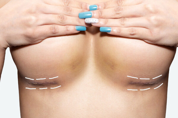 Breast Lift Surgery Abu Dhabi
