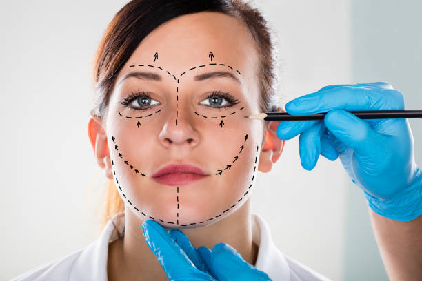 Does Facelift Leave Visible Scars