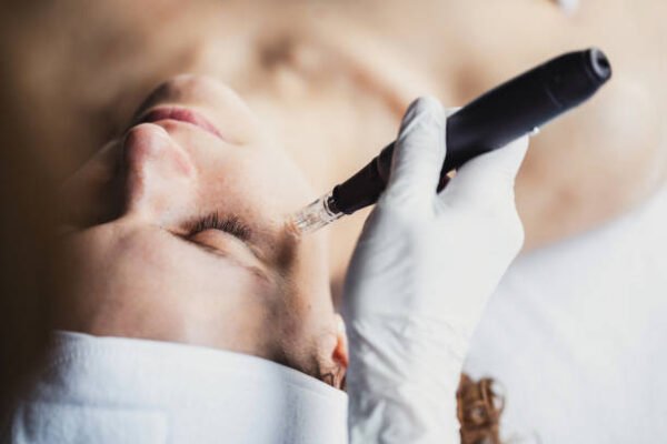 Does Microneedling Stimulate Natural Collagen