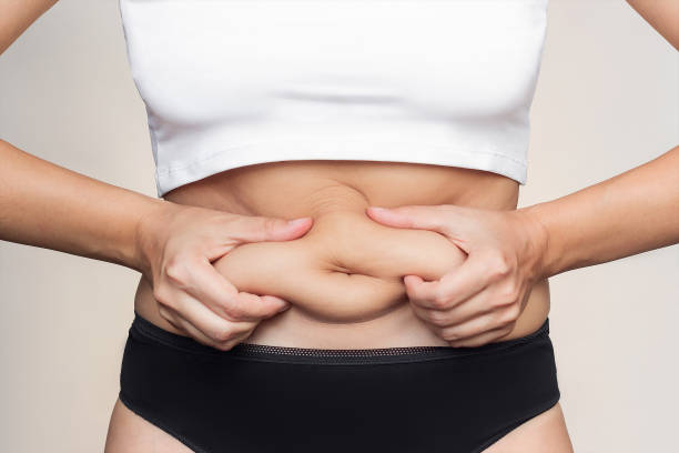 Does Mini Abdominoplasty improve abdominal firmness