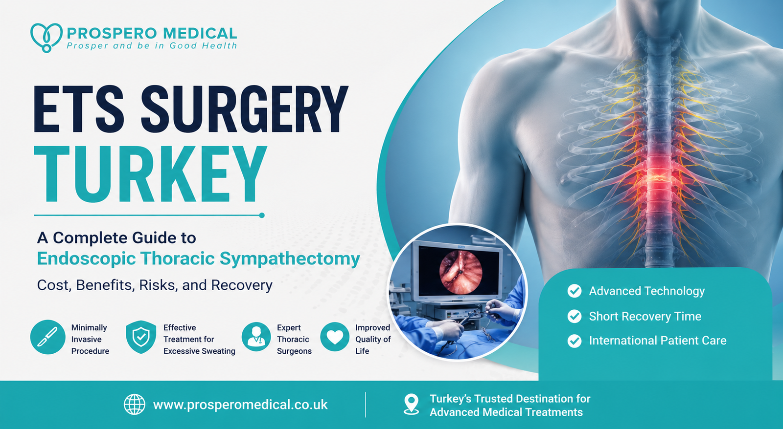 Endoscopic Thoracic Sympathectomy Turkey
