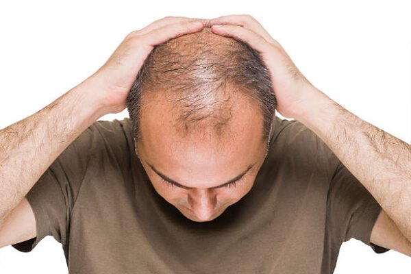 How Does PRP Hair Treatment Improve Hair Growth Cycles