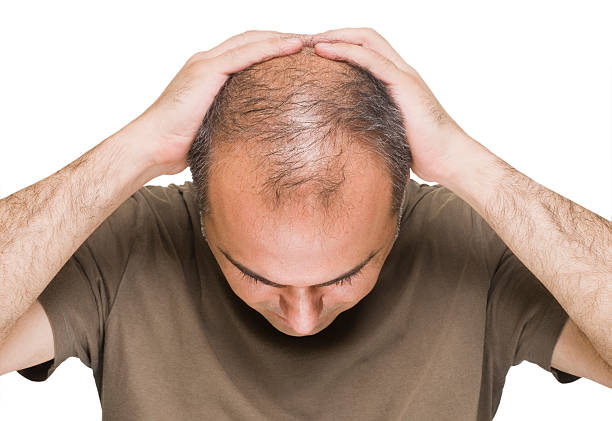 How Does PRP Hair Treatment Improve Hair Growth Cycles