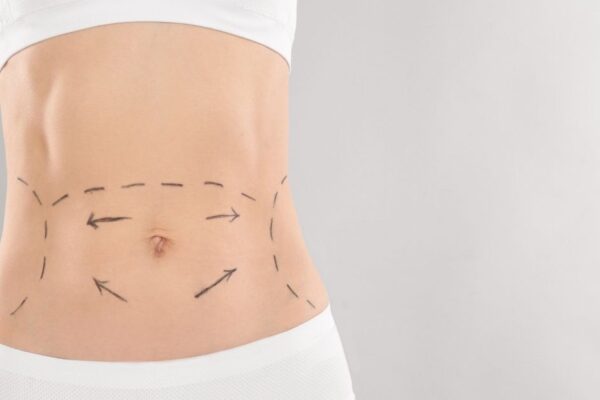 Tummy Tuck Abu Dhabi