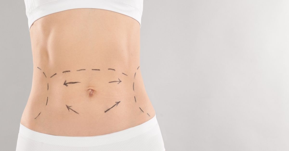 Tummy Tuck Abu Dhabi