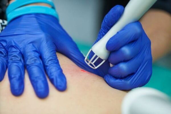 Laser Scar Removal in Abu Dhabi