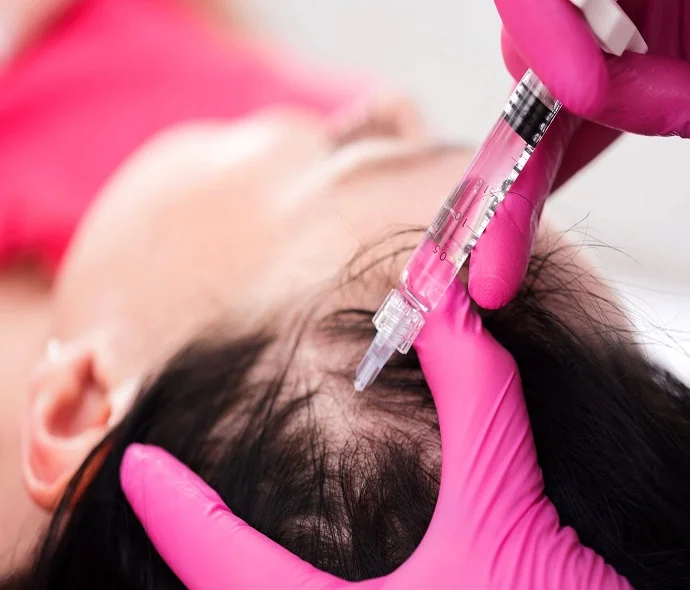 Hair Fillers Treatment in Abu Dhabi
