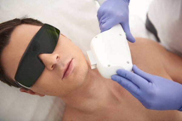 Is Beard Laser Hair Removal a long-term solution