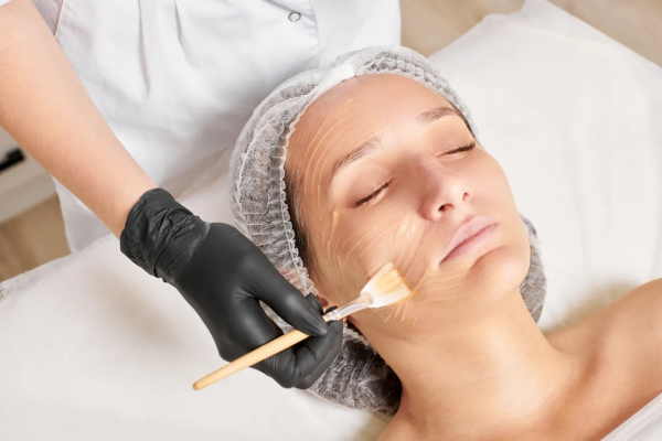 Chemical peel Abu Dhabi