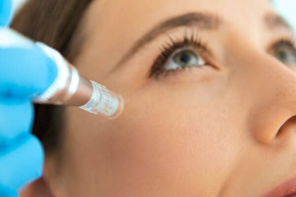 Is Dermapen Treatment Safe for Sensitive Skin