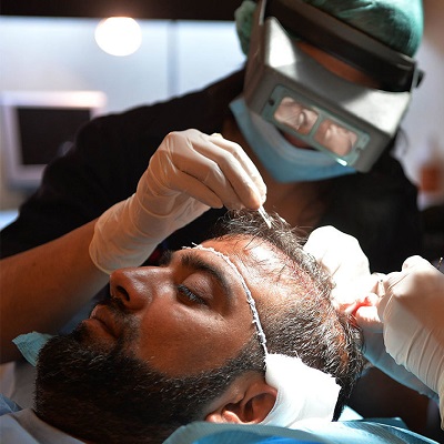 زراعة الشعر في دبي