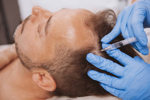 Is PRP Treatment suitable for men and women