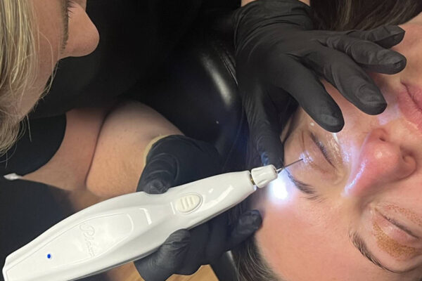 Plexr Plasma Eyelift in Abu Dhabi
