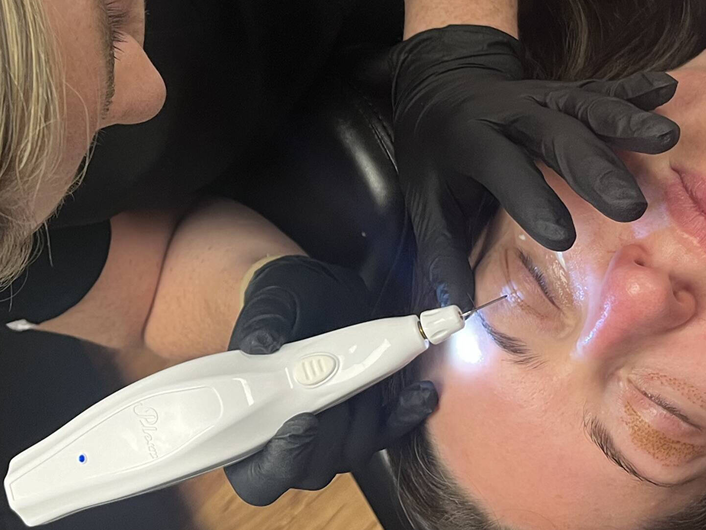 Plexr Plasma Eyelift in Abu Dhabi