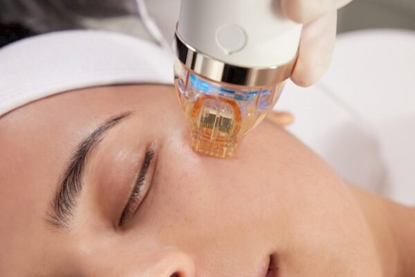 RF Micro Needling Abu Dhabi