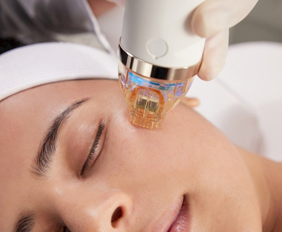 RF Micro Needling Abu Dhabi