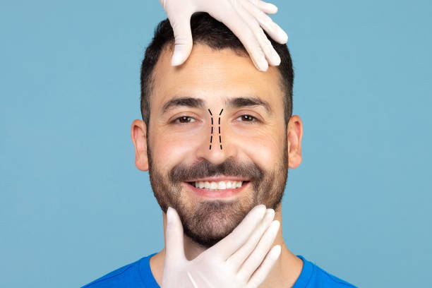 Is Rhinoplasty suitable for men and women