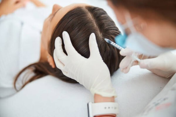 Who Is the Best Candidate for PRP Hair Treatment