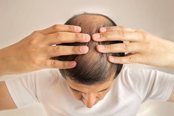 Who Should Choose GFC Treatment for Hair