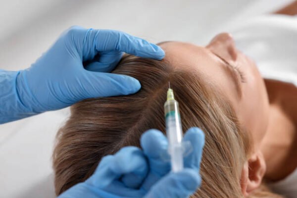 Who Should Choose PRP Hair Treatment for Hair Loss