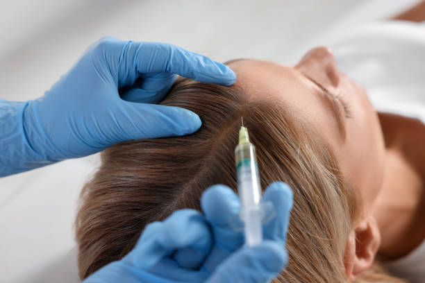 Who Should Choose PRP Hair Treatment for Hair Loss