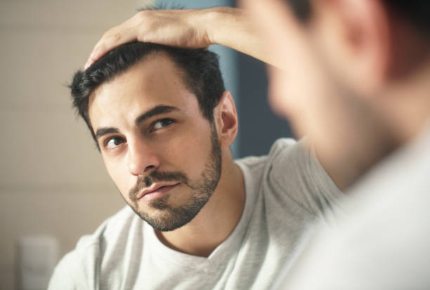 Why Choose Hair Transplant Over Temporary Fixes