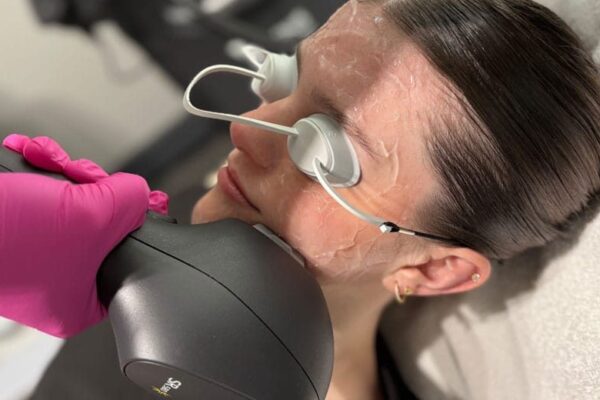 skin tightening treatment edmonton