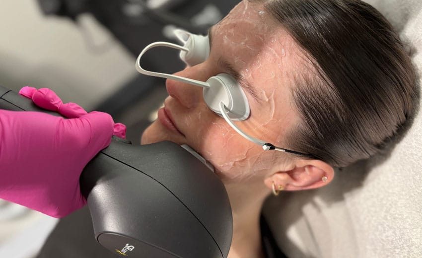 skin tightening treatment edmonton
