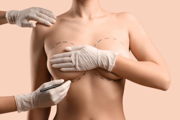 Breast Augmentation in Dubai