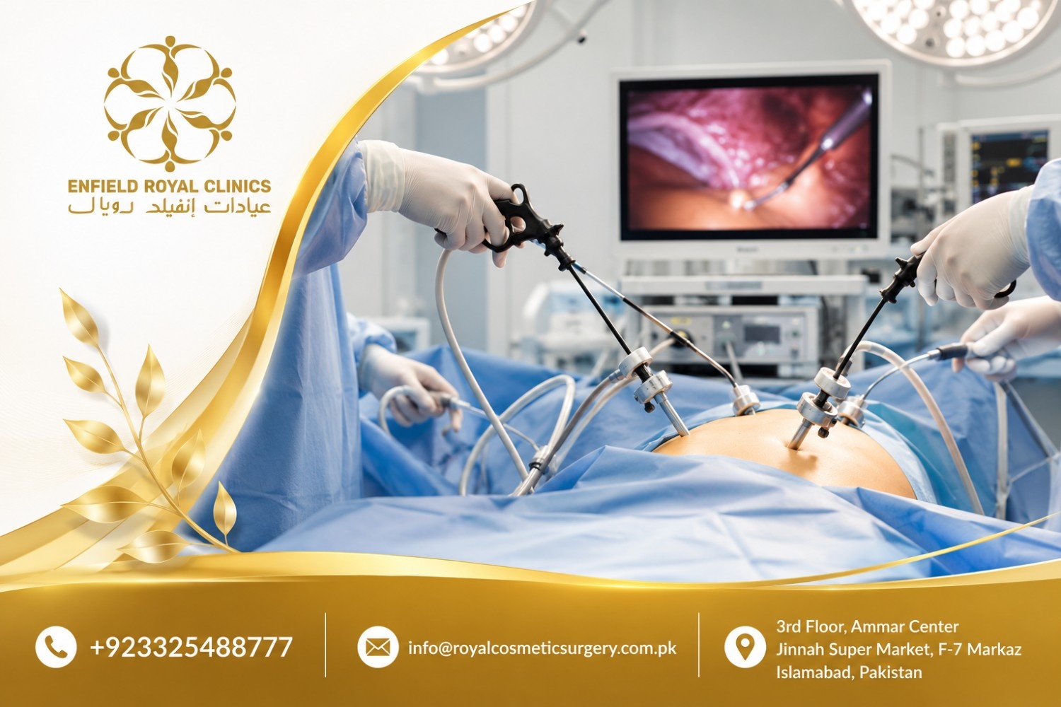 laparoscopic surgery