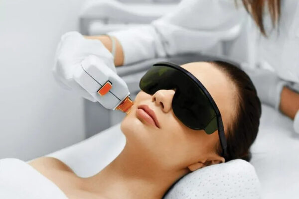 laser hair removal edmonton